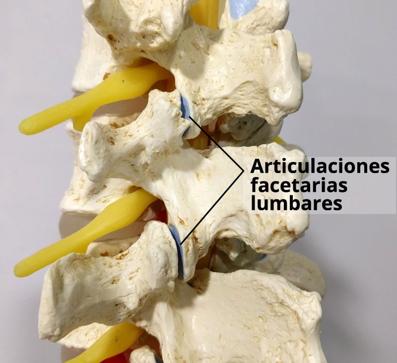 dolor-facetario-lumbar